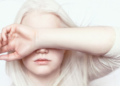 Person with Albinism