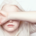 Person with Albinism