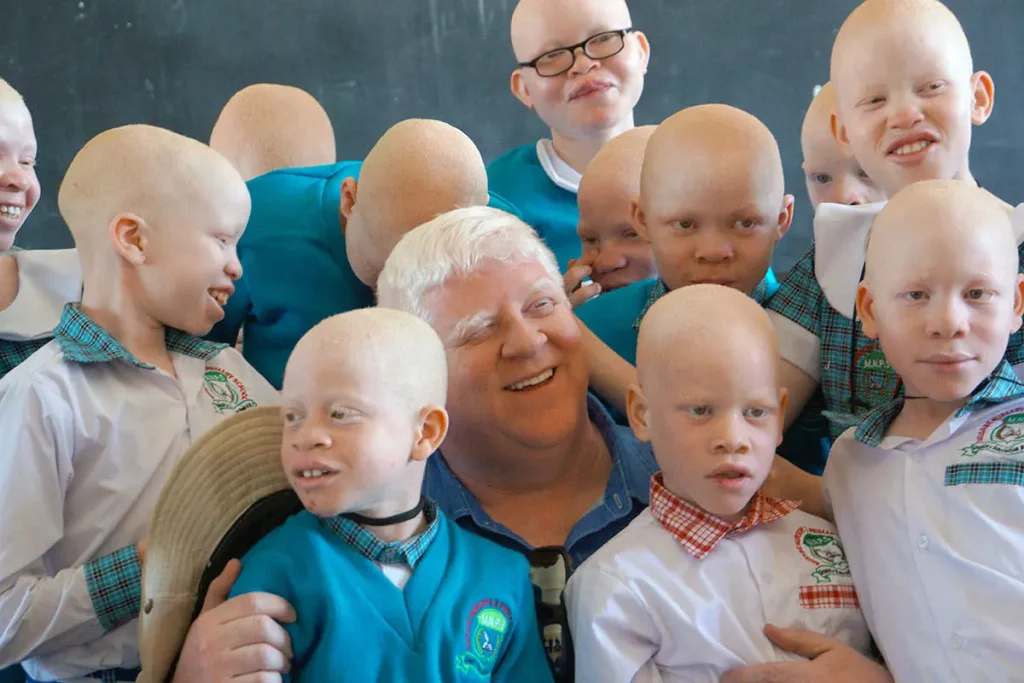 UN Expert Warns Colour Discrimination Harms Persons with Albinism 3 persons with albinism