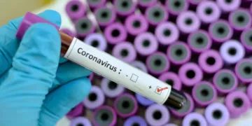 GHS To Aid False COVID-19 Test Results Investigation